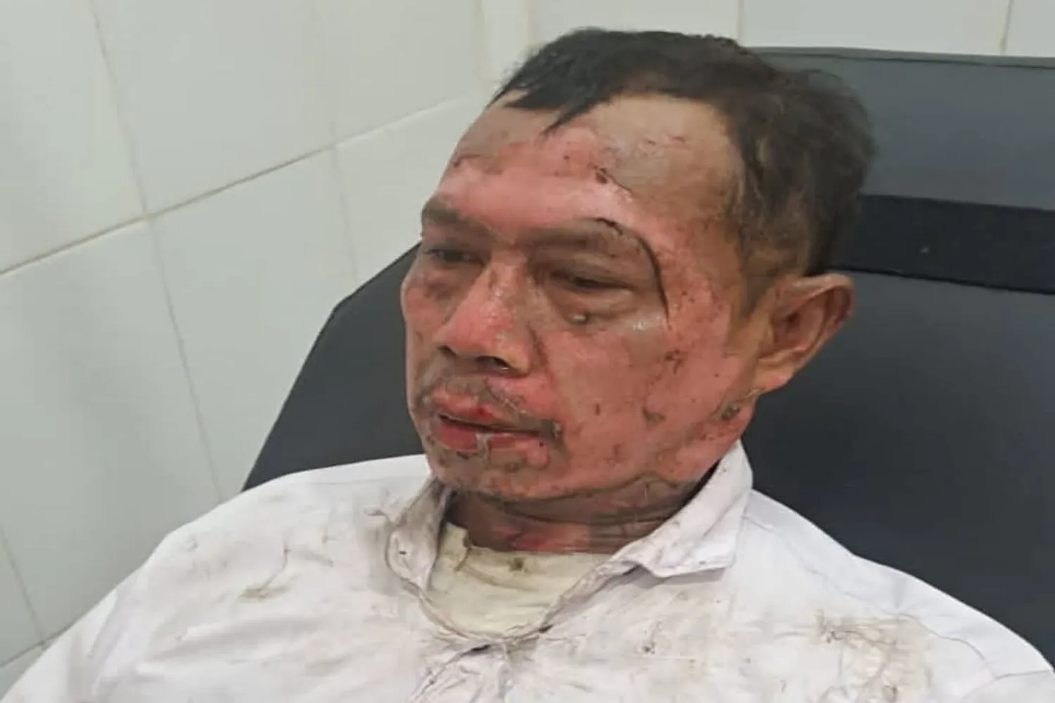 Pawai Obor Tahun Baru Islam di Purwakarta Makan Korban, Peserta Alami Luka Bakar Serius Saat Atraksi Sembur Api 1 Pawai Obor Tahun Baru Islam di Purwakarta Makan Korban, Peserta Alami Luka Bakar Serius Saat Atraksi Sembur Api