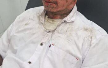 Pawai Obor Tahun Baru Islam di Purwakarta Makan Korban, Peserta Alami Luka Bakar Serius Saat Atraksi Sembur Api 3 Pawai Obor Tahun Baru Islam di Purwakarta Makan Korban, Peserta Alami Luka Bakar Serius Saat Atraksi Sembur Api