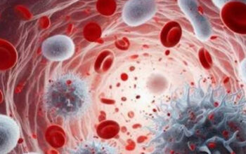 Bahaya Anemia pada Remaja Putri dan Cara Mencegahnya 3 Bahaya Anemia pada Remaja Putri dan Cara Mencegahnya