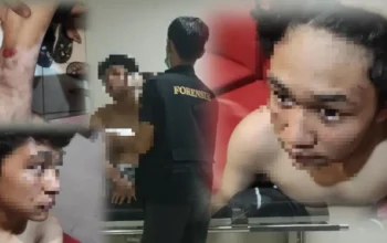 Disundut Rokok hingga Kaki Dilindas Motor, Anak di Bawah Umur di Bogor Jadi Korban Pengeroyokan 3 Disundut Rokok hingga Kaki Dilindas Motor, Anak di Bawah Umur di Bogor Jadi Korban Pengeroyokan