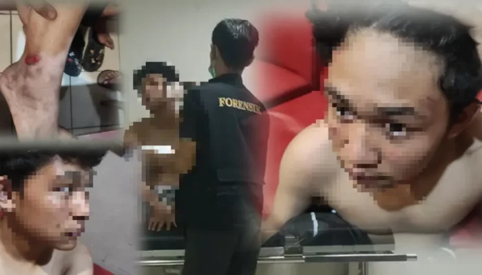 Disundut Rokok hingga Kaki Dilindas Motor, Anak di Bawah Umur di Bogor Jadi Korban Pengeroyokan