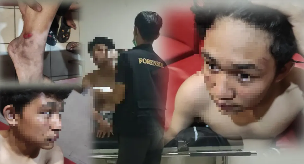 Disundut Rokok hingga Kaki Dilindas Motor, Anak di Bawah Umur di Bogor Jadi Korban Pengeroyokan