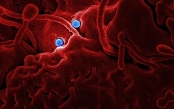 Shamonda Virus Ditemukan pada Manusia, Seberapa Berbahaya? 3 Shamonda Virus Ditemukan pada Manusia, Seberapa Berbahaya?